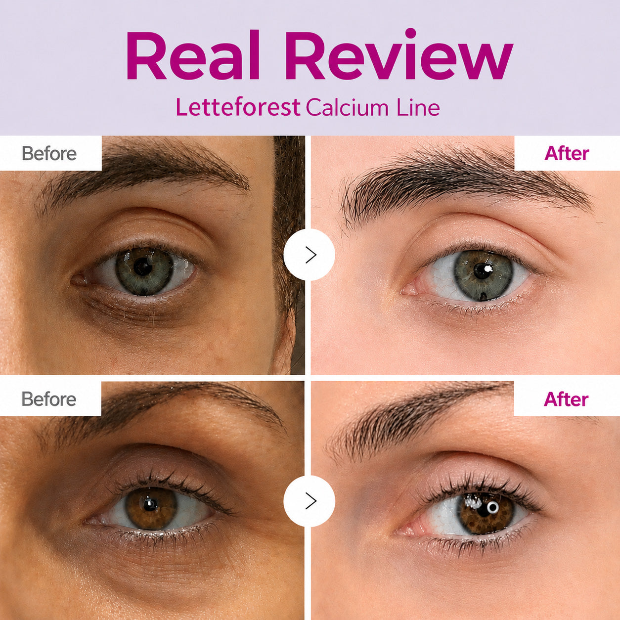 🔥LAST DAY 50% OFF!!Letteforest Korean Calcium Dark Spot Eye Cream