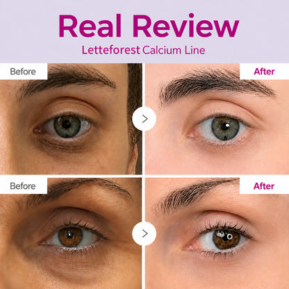 🔥LAST DAY 50% OFF!!Letteforest Korean Calcium Dark Spot Eye Cream