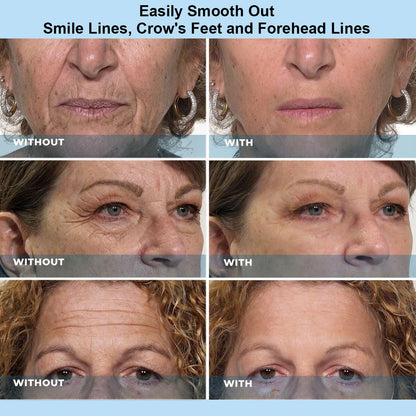 Letteforest™ Instant Face Temporary Tightener – Instant visible results in 30 seconds