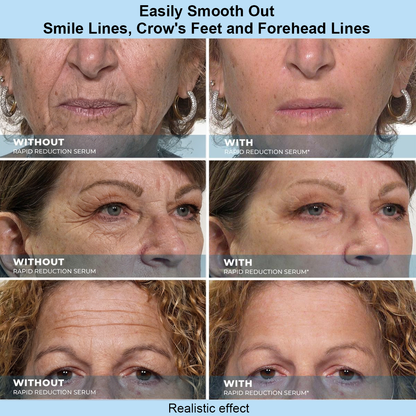 Letteforest™ Instant Face Temporary Tightener – Instant visible results in 30 seconds