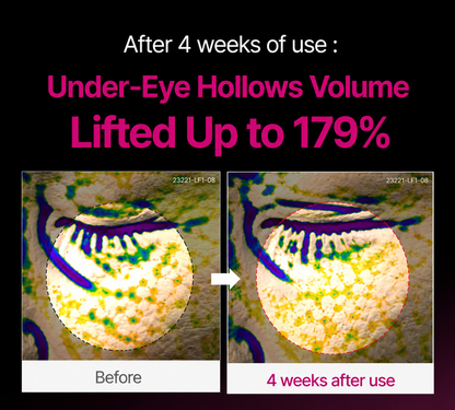 🔥LAST DAY 50% OFF!!Letteforest Korean Calcium Dark Spot Eye Cream